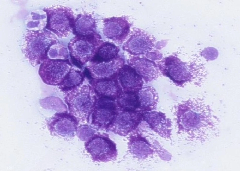 Blick durchs Mikroskop: Nach der Probenentnahme und Färbung können Tierärztinnen und Tierärzte anhand des Zellbildes erkennen, um welche Veränderung es sich handeln könnte – hier beispielhaft ein Mastzelltumor.